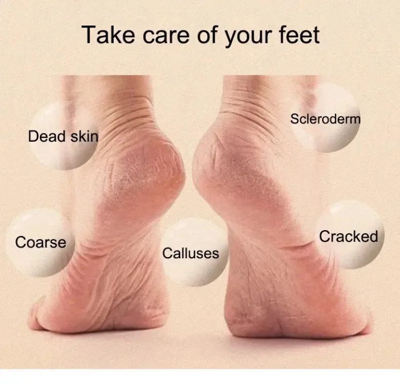 LunaWand™ Nuve Foot Care Magic